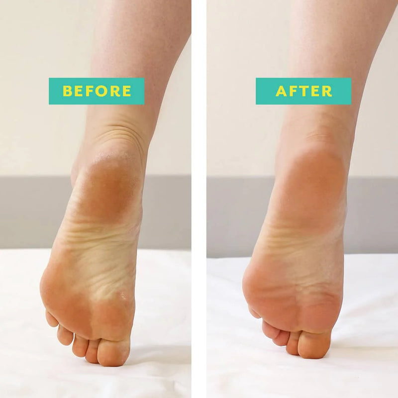 Pedi Cure - Foot Peel Mask
