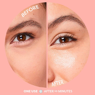 Served Chill Bubbly - Brightening Eye Gels