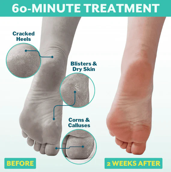 Pedi Cure - Foot Peel Mask